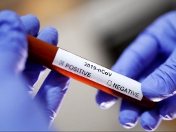 В МОЗ отрапортовали о рекордном числе выздоровевших от коронавируса