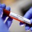 В Украине за сутки зафиксировано 11 новых случаев заражения коронавирусом