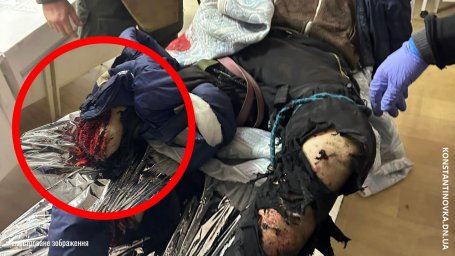 Евакуація під обстрілами: у Костянтинівці волонтери врятували пораненого чоловіка